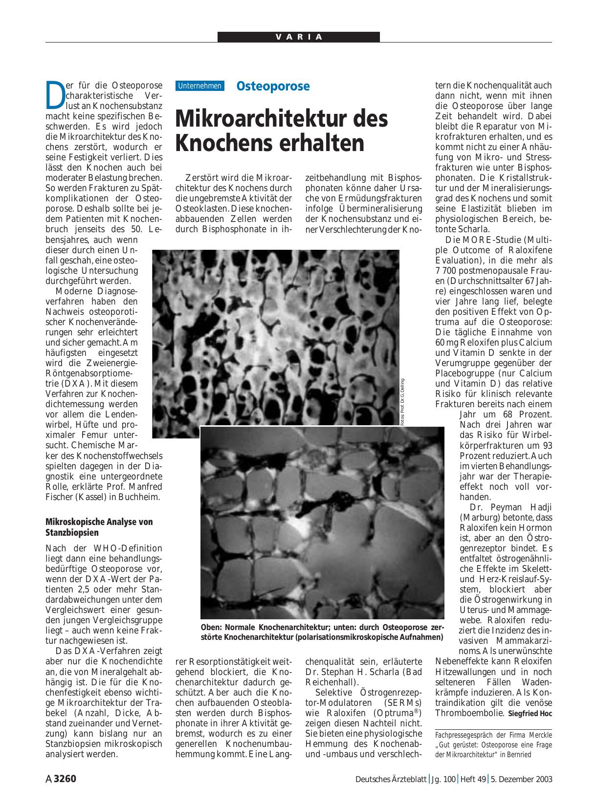 Vorschauseite 1: Osteoporose: Mikroarchitektur des Knochens erhalten