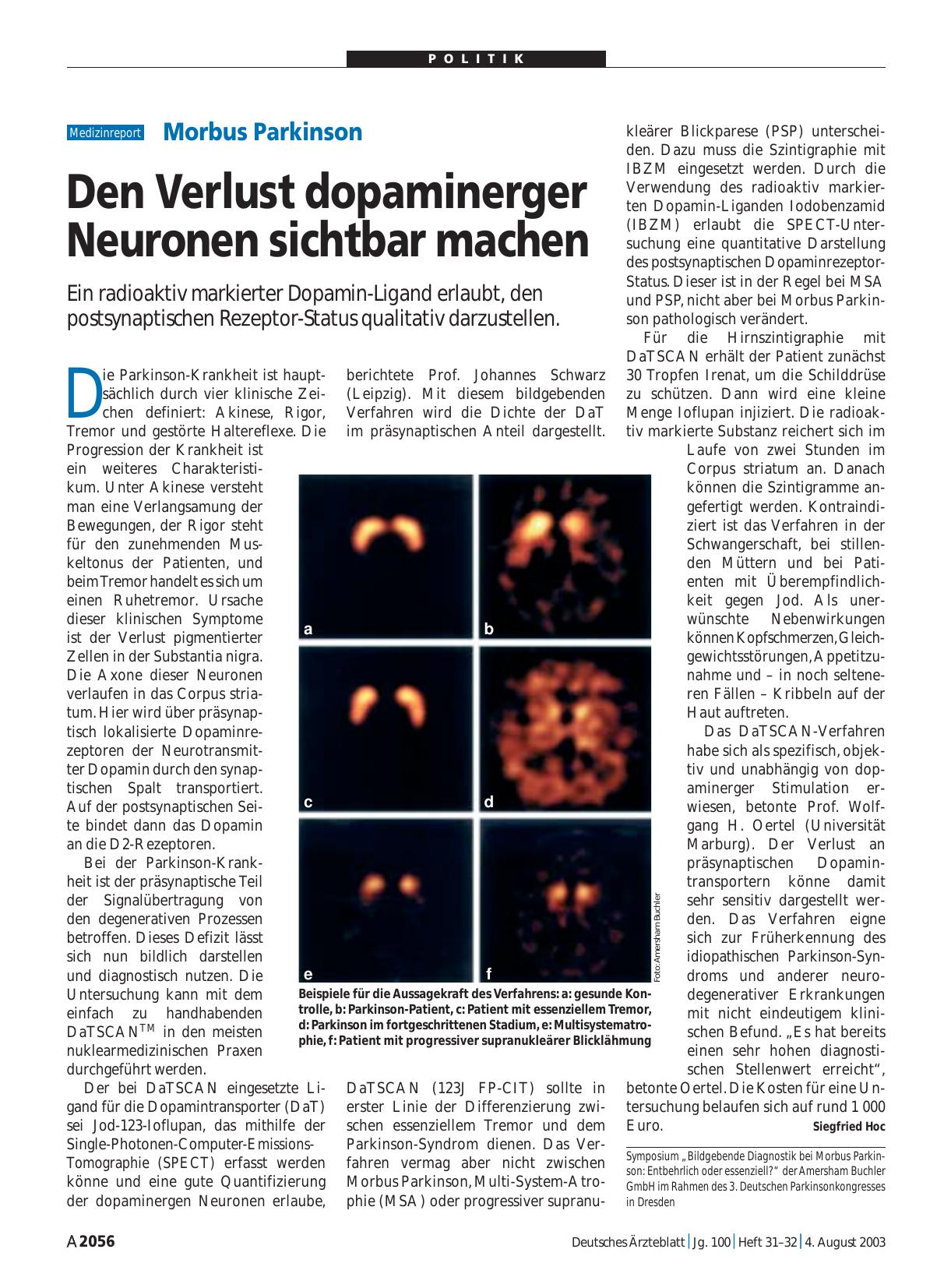 Vorschauseite 1: Morbus Parkinson: Den Verlust dopaminerger Neuronen sichtbar machen