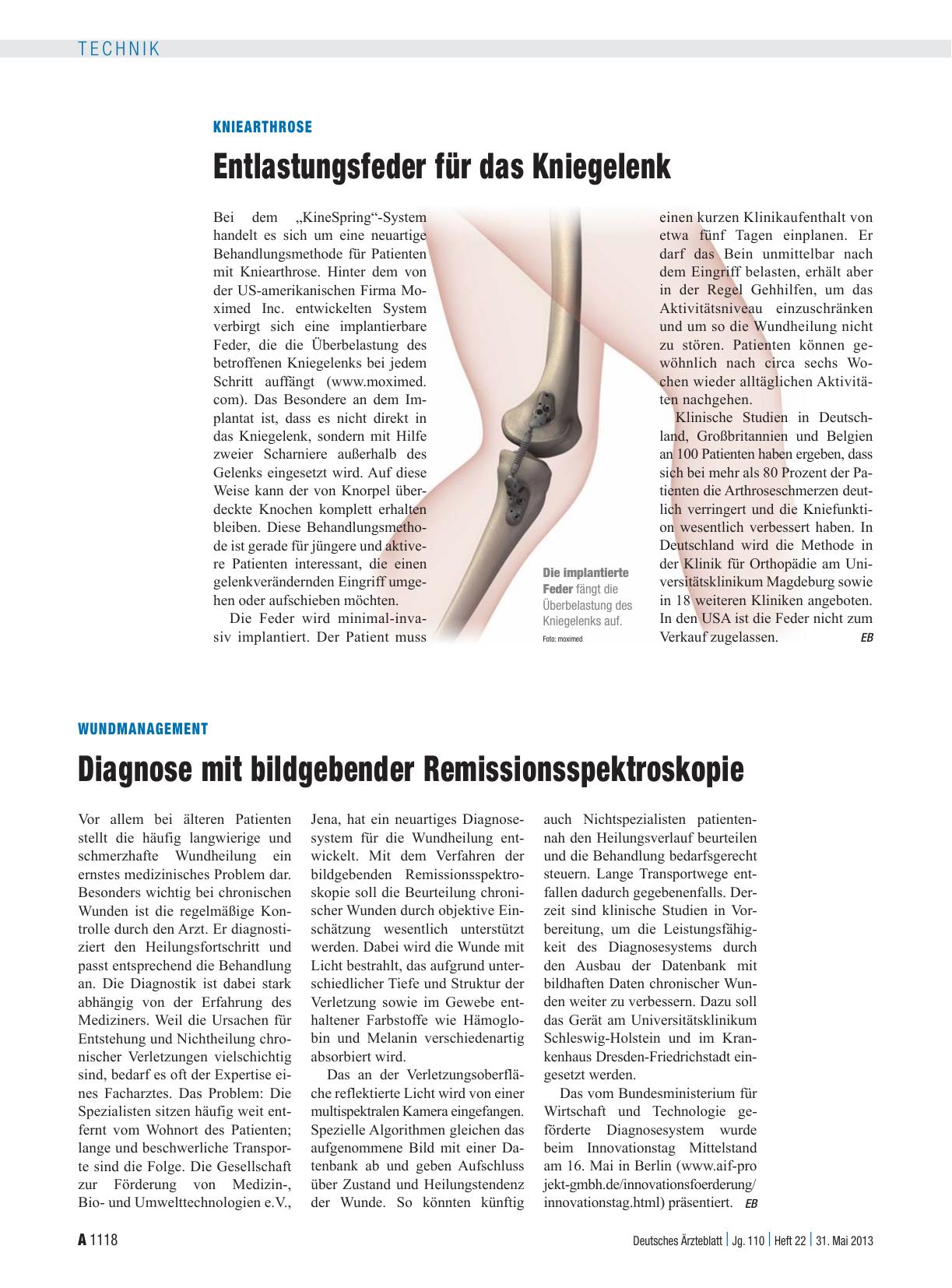 Vorschauseite 1: Kniearthrose: Entlastungsfeder für das Kniegelenk