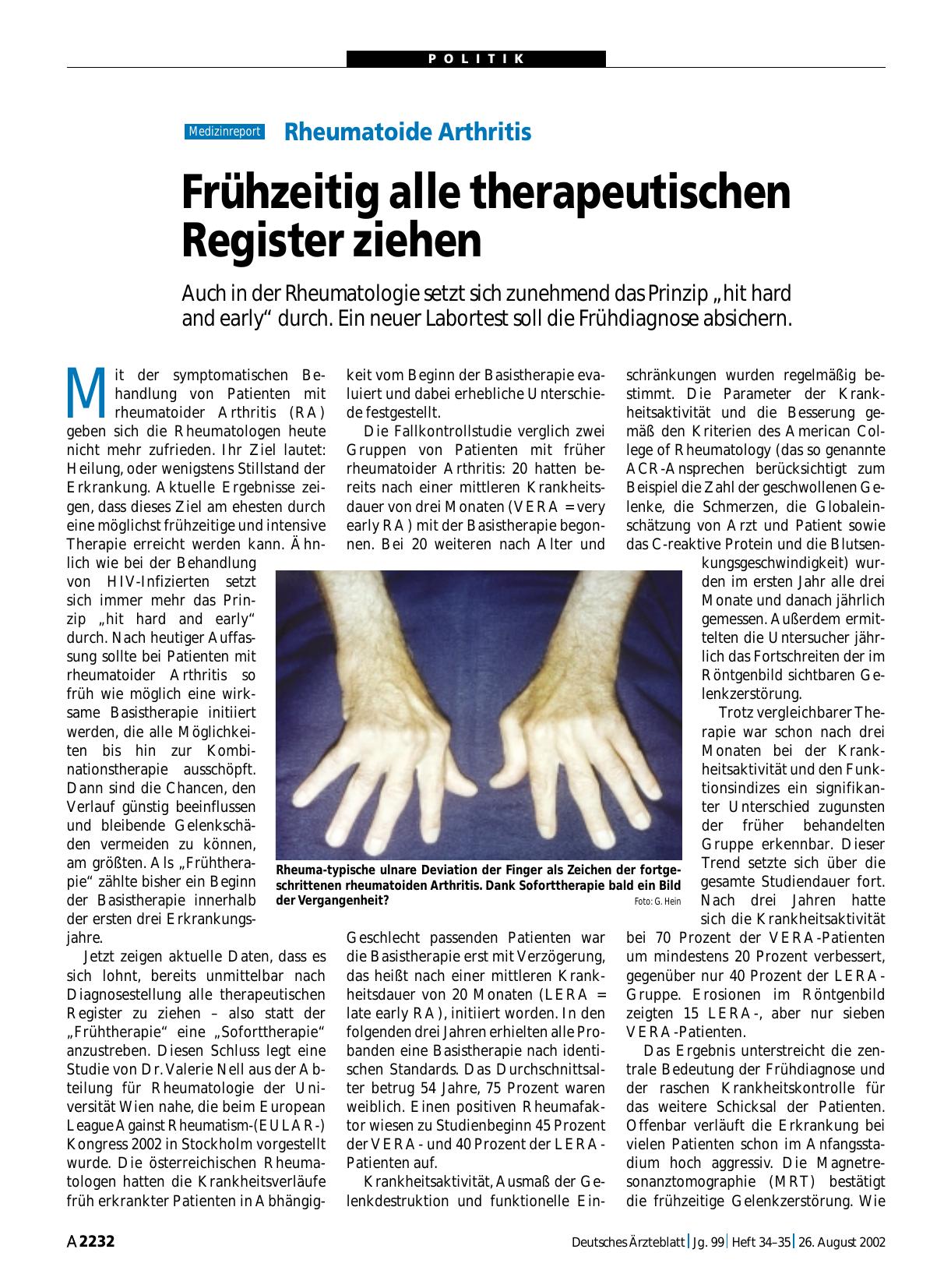 Vorschauseite 1: Rheumatoide Arthritis: Frühzeitig alle therapeutischen Register ziehen