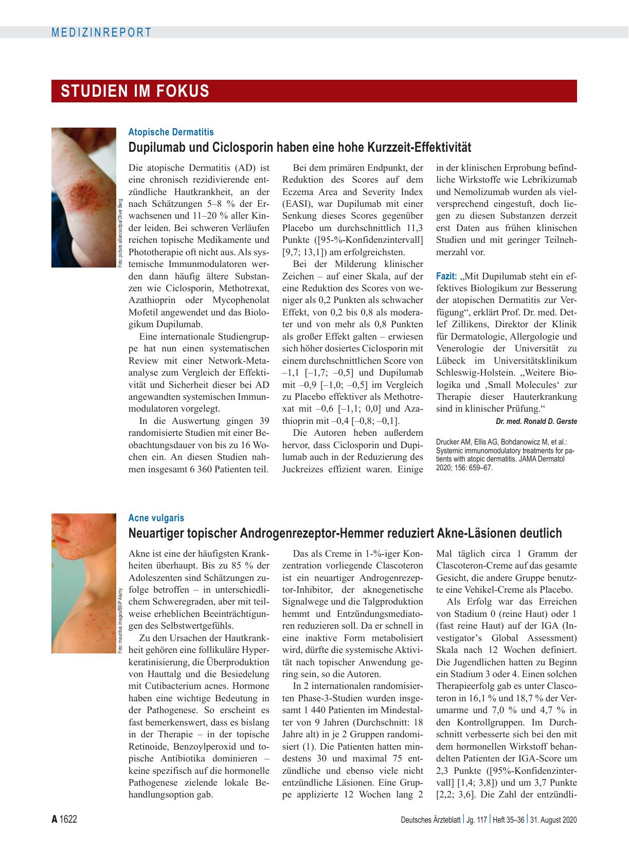 Vorschauseite 1: Atopische Dermatitis: Dupilumab und Ciclosporin haben eine hohe Kurzzeit-Effektivität