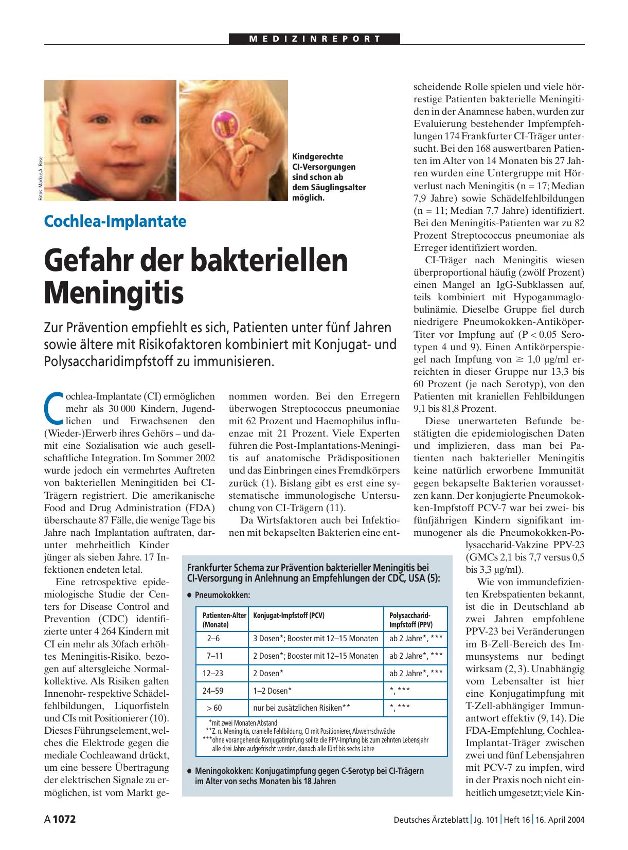 Vorschauseite 1: Cochlea-Implantate: Gefahr der bakteriellen Meningitis