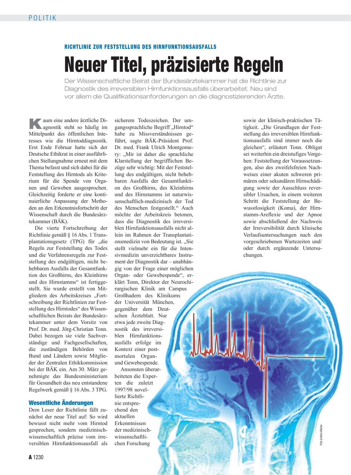 Vorschauseite 1: Richtlinie zur Feststellung des Hirnfunktionsausfalls: Neuer Titel, präzisierte Regeln