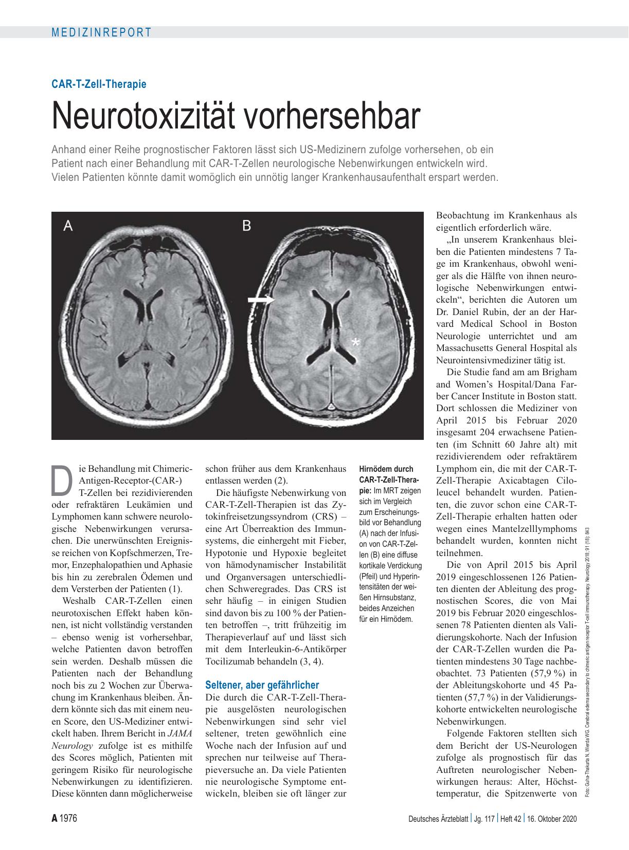Vorschauseite 1: CAR-T-Zell-Therapie: Neurotoxizität vorhersehbar