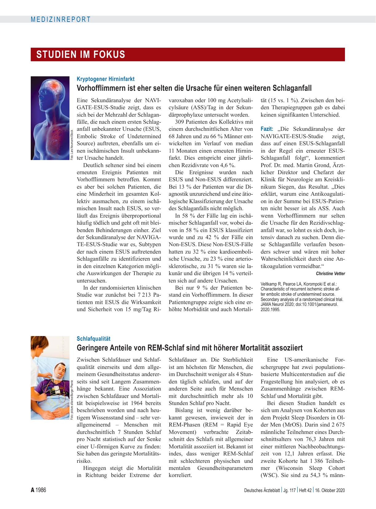 Vorschauseite 1: Kryptogener Hirninfarkt: Vorhofflimmern ist eher selten die Ursache für einen weiteren Schlaganfall