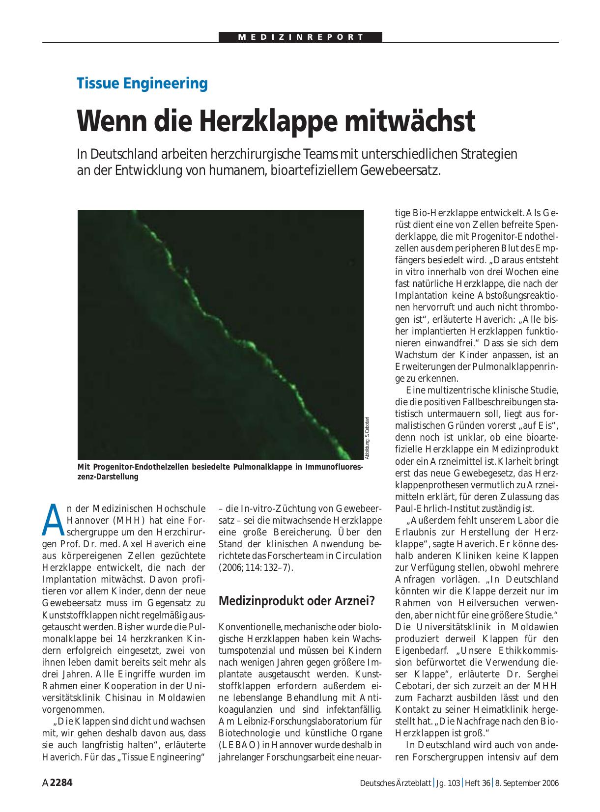 Vorschauseite 1: Tissue Engineering: Wenn die Herzklappe mitwächst