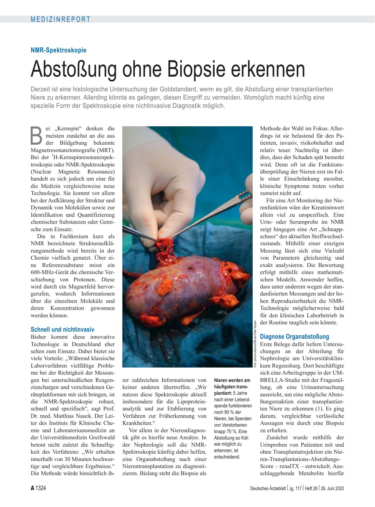 Vorschauseite 1: NMR-Spektroskopie: Abstoßung ohne Biopsie erkennen