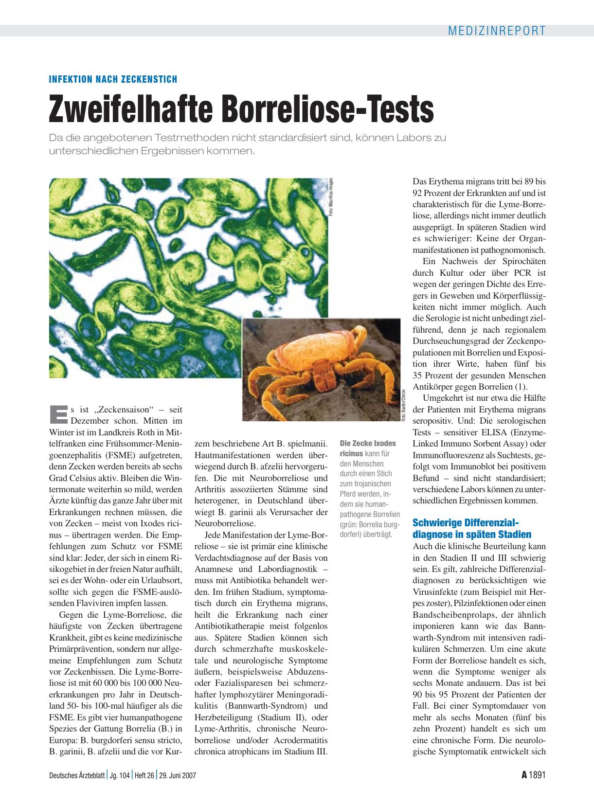 Vorschauseite 1: Infektion nach Zeckenstich: Zweifelhafte Borreliose-Tests