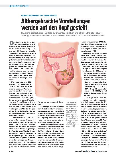 Vorschauseite 1: Divertikelkrankheit und Divertikulitis: Althergebrachte Vorstellungen werden auf den Kopf gestellt