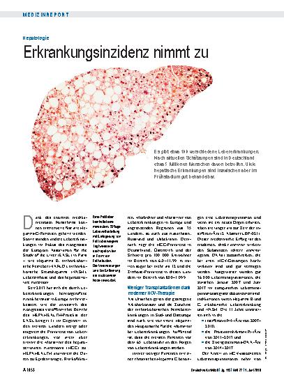 Vorschauseite 1: Hepatologie: Erkrankungsinzidenz nimmt zu