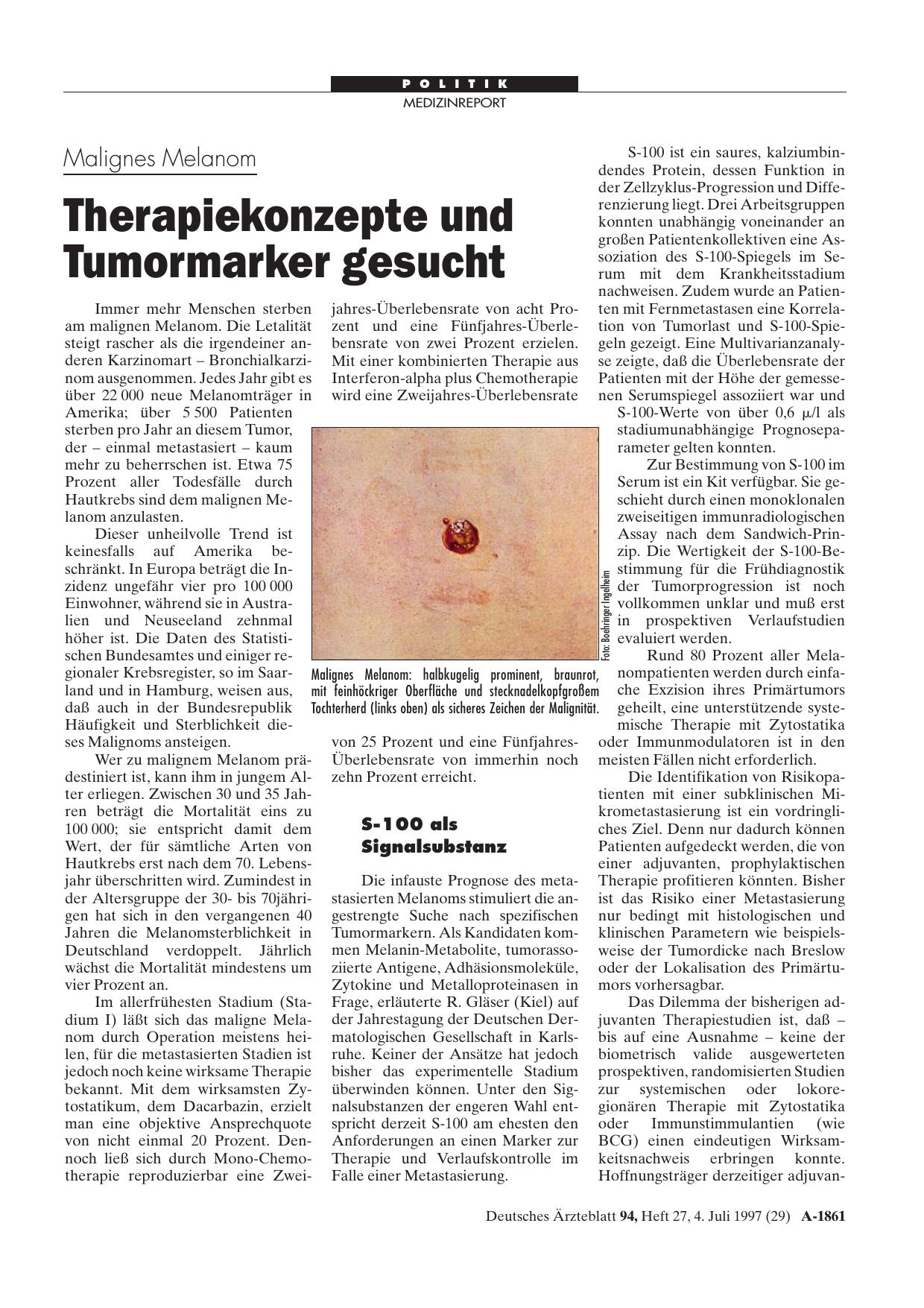 Vorschauseite 1: Malignes Melanom: Therapiekonzepte und Tumormarker gesucht