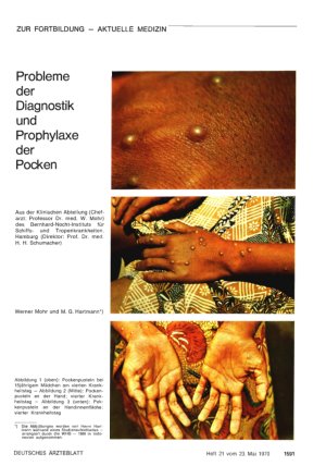 Vorschauseite 1: Probleme der Diagnostik und Prophylaxe der Pocken