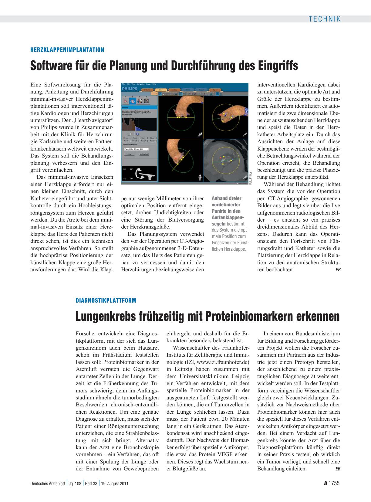 Vorschauseite 1: Diagnostikplattform: Lungenkrebs frühzeitig mit Proteinbiomarkern erkennen