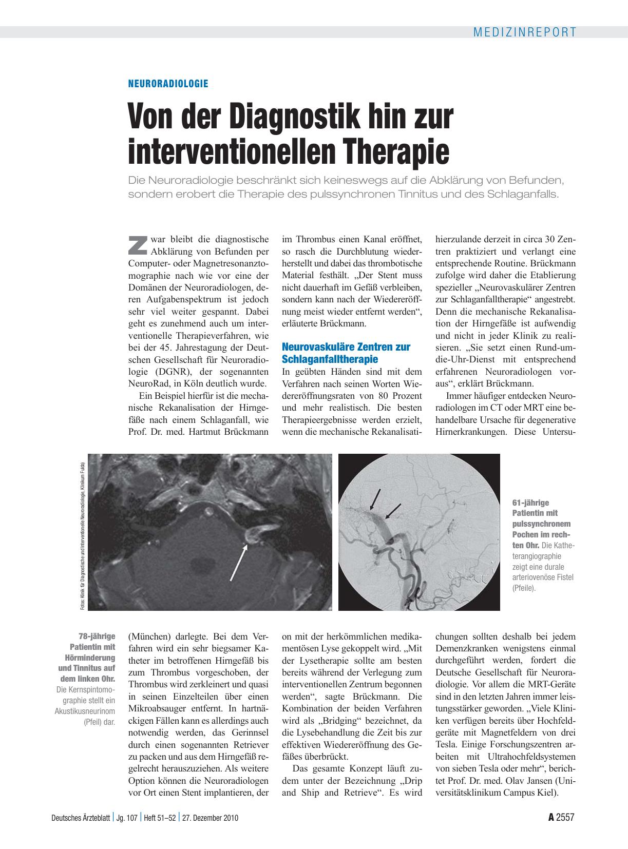 Vorschauseite 1: Neuroradiologie: Von der Diagnostik hin zur interventionellen Therapie