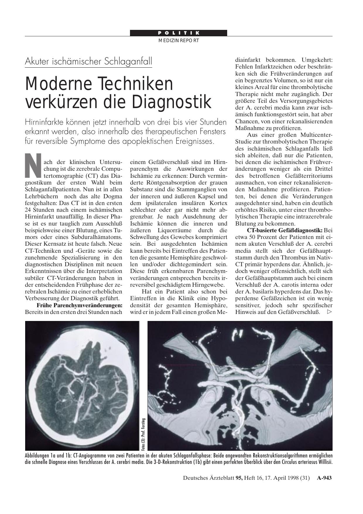 Vorschauseite 1: Akuter ischämischer Schlaganfall: Moderne Techniken verkürzen die Diagnostik
