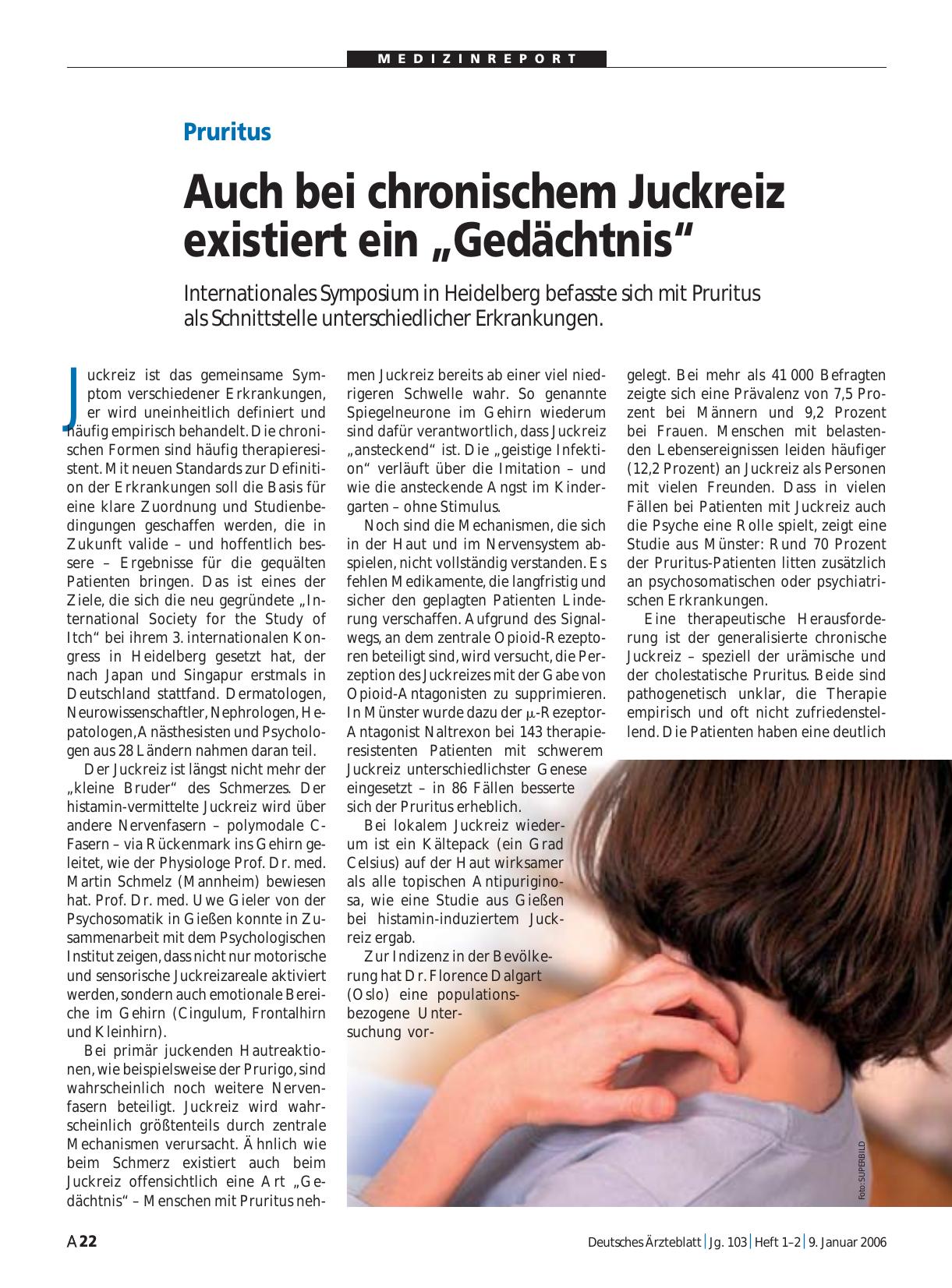 Vorschauseite 1: Pruritus: Auch bei chronischem Juckreiz existiert ein „Gedächtnis“