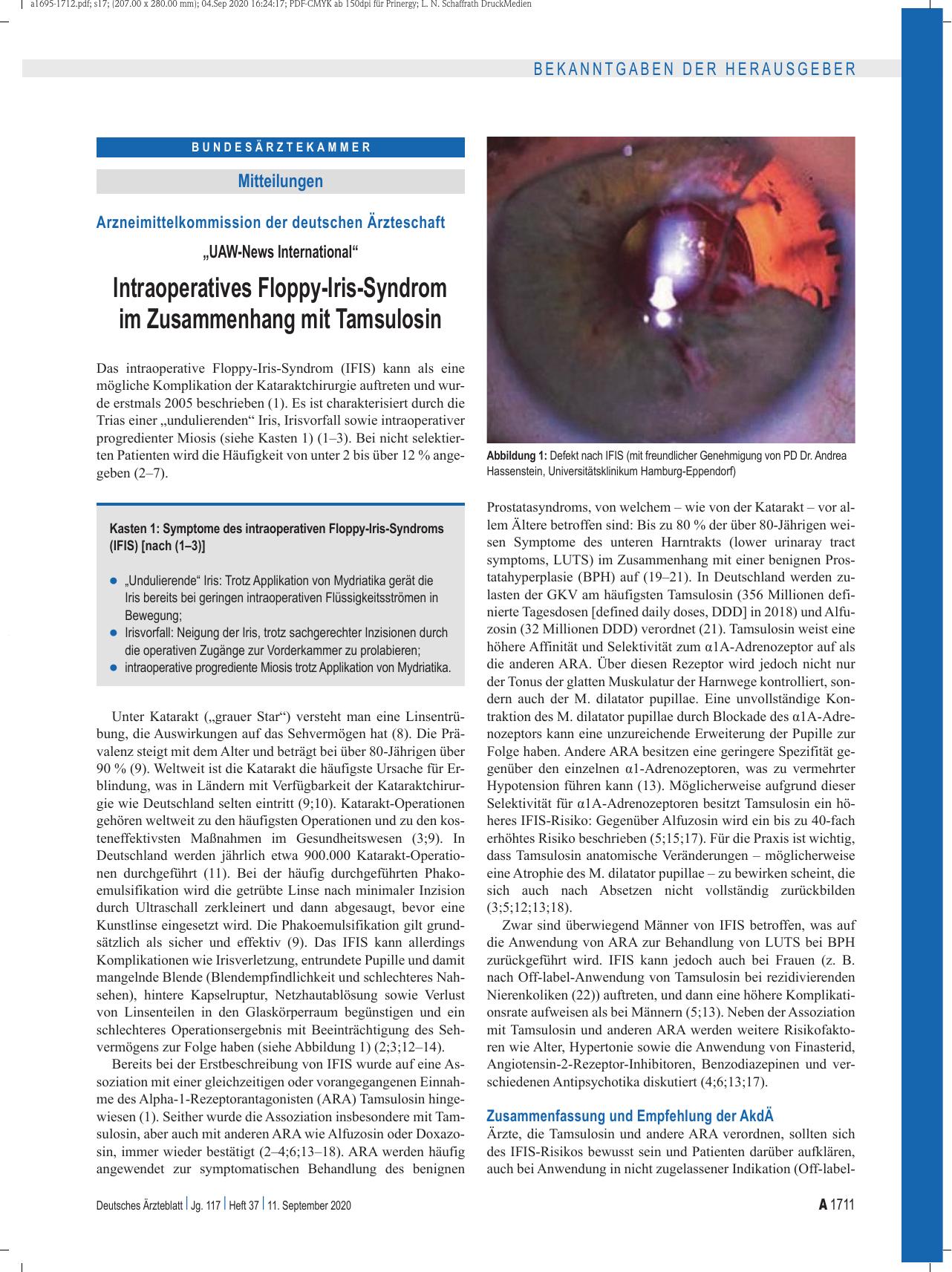 Vorschauseite 1: Arzneimittelkommission der deutschen Ärzteschaft: „UAW-News International“ Intraoperatives Floppy-Iris-Syndrom im Zusammenhang mit Tamsulosin Literatur