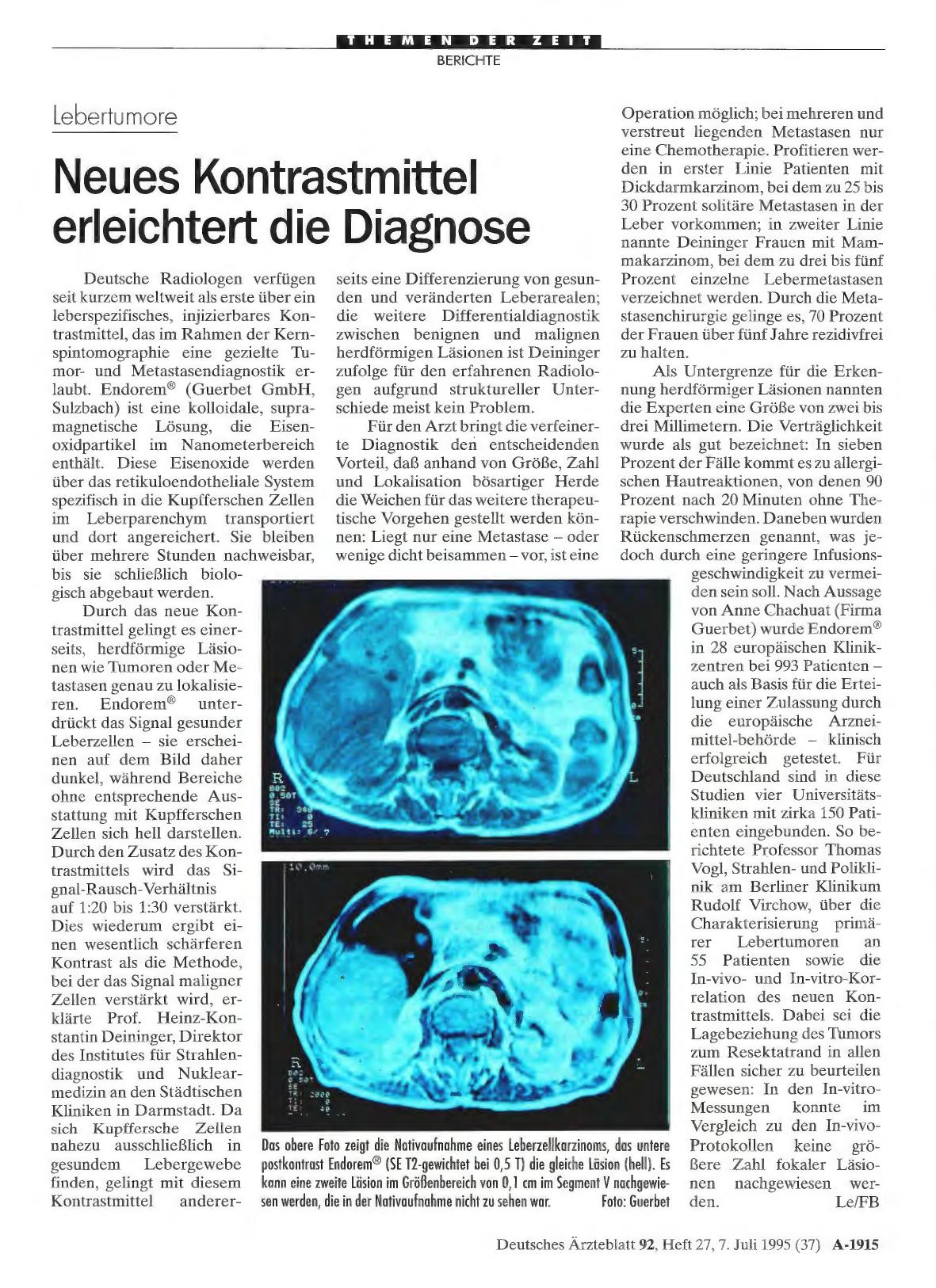 Vorschauseite 1: Lebertumore: Neues Kontrastmittel erleichtert die Diagnose