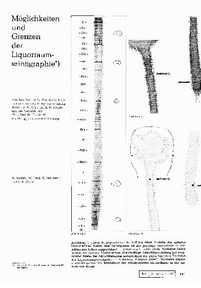 Vorschauseite 1: Möglichkeiten und Grenzen der Liquorraumszintigraphie