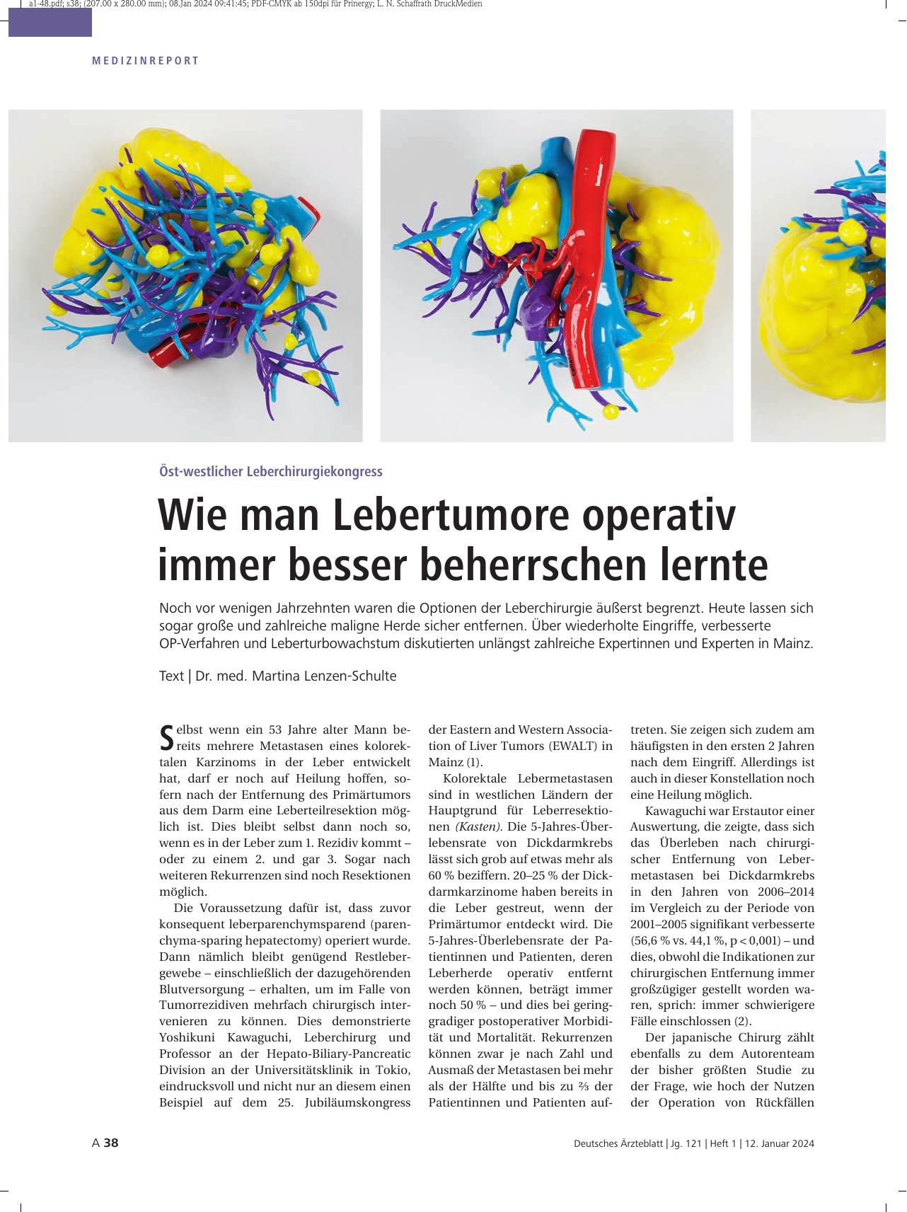 Vorschauseite 1: Öst-westlicher Leberchirurgiekongress: Wie man Lebertumore operativ immer besser beherrschen lernte