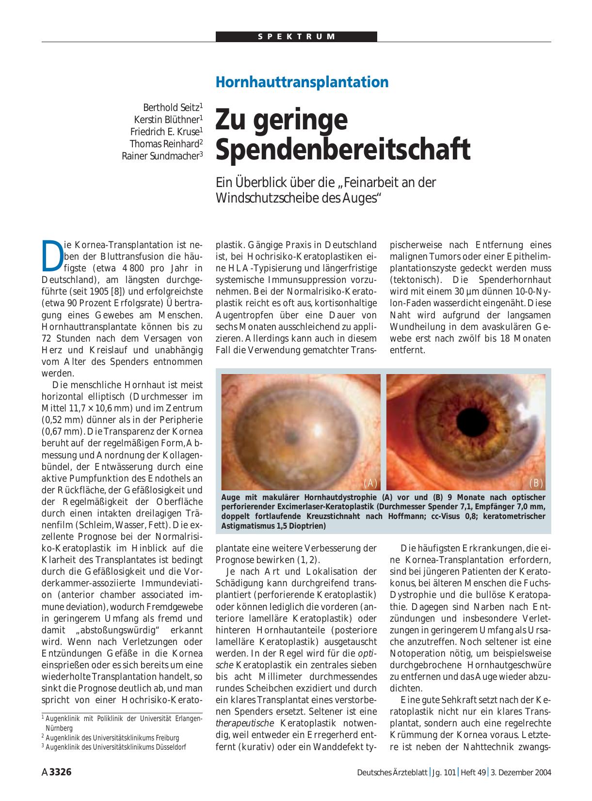 Vorschauseite 1: Hornhauttransplantation: Zu geringe Spendenbereitschaft