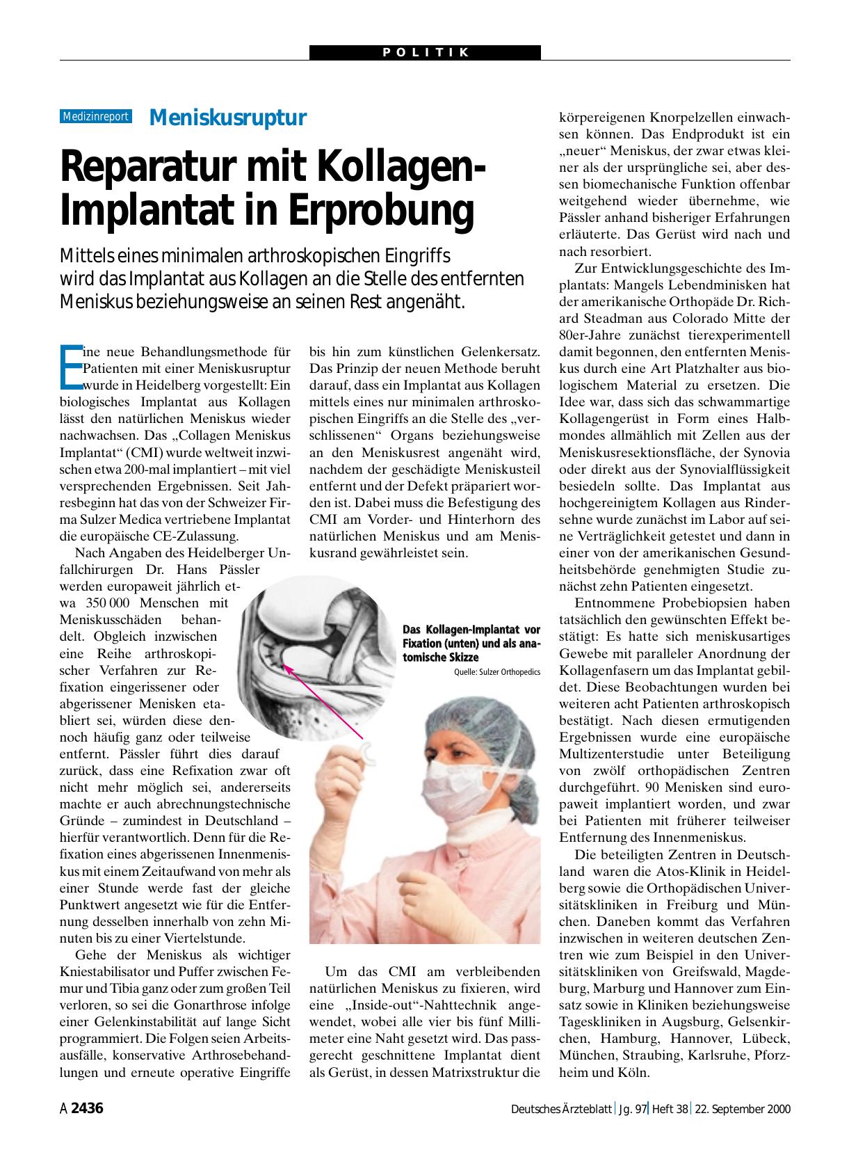 Vorschauseite 1: Meniskusruptur: Reparatur mit Kollagen-Implantat in Erprobung