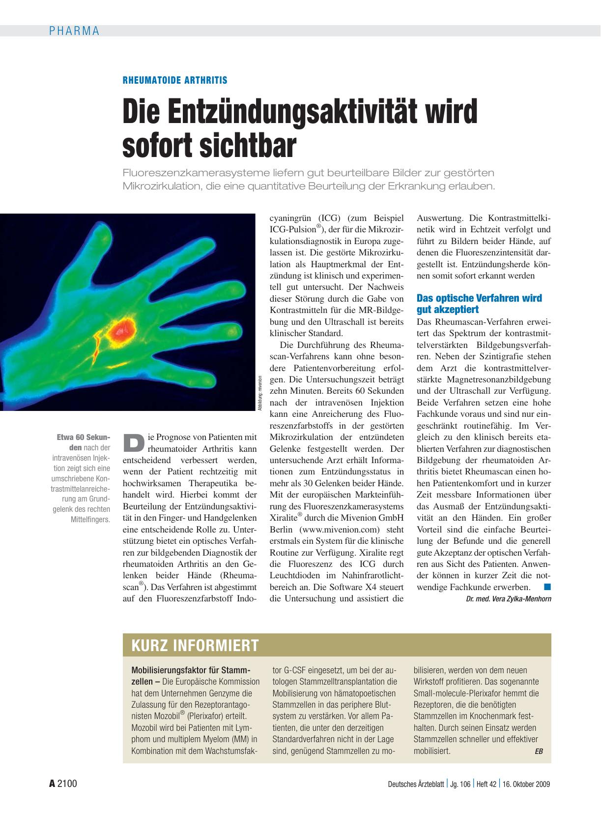 Vorschauseite 1: Rheumatoide Arthritis: Die Entzündungsaktivität wird sofort sichtbar