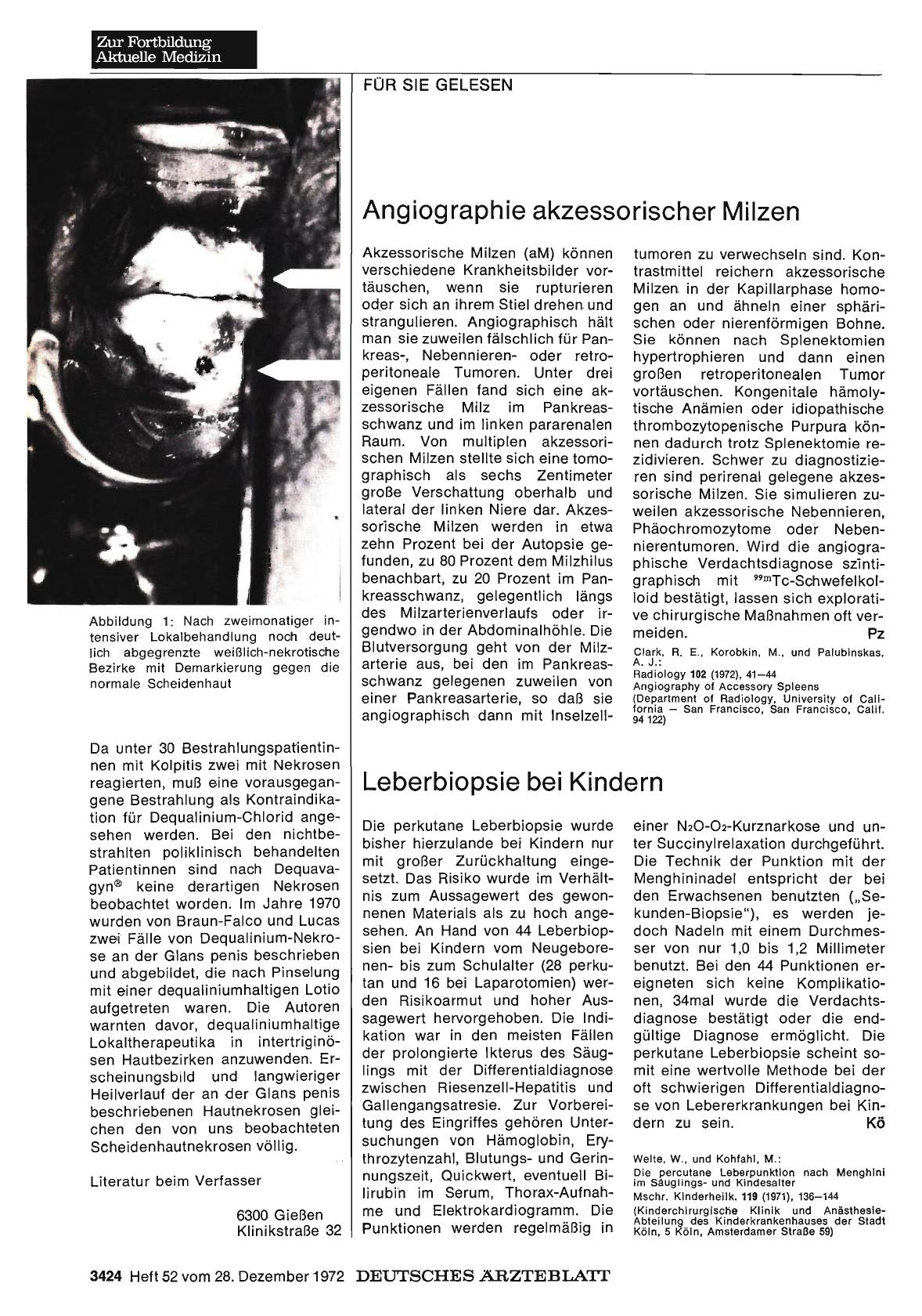Vorschauseite 1: Angiographie akzessorischer Milzen