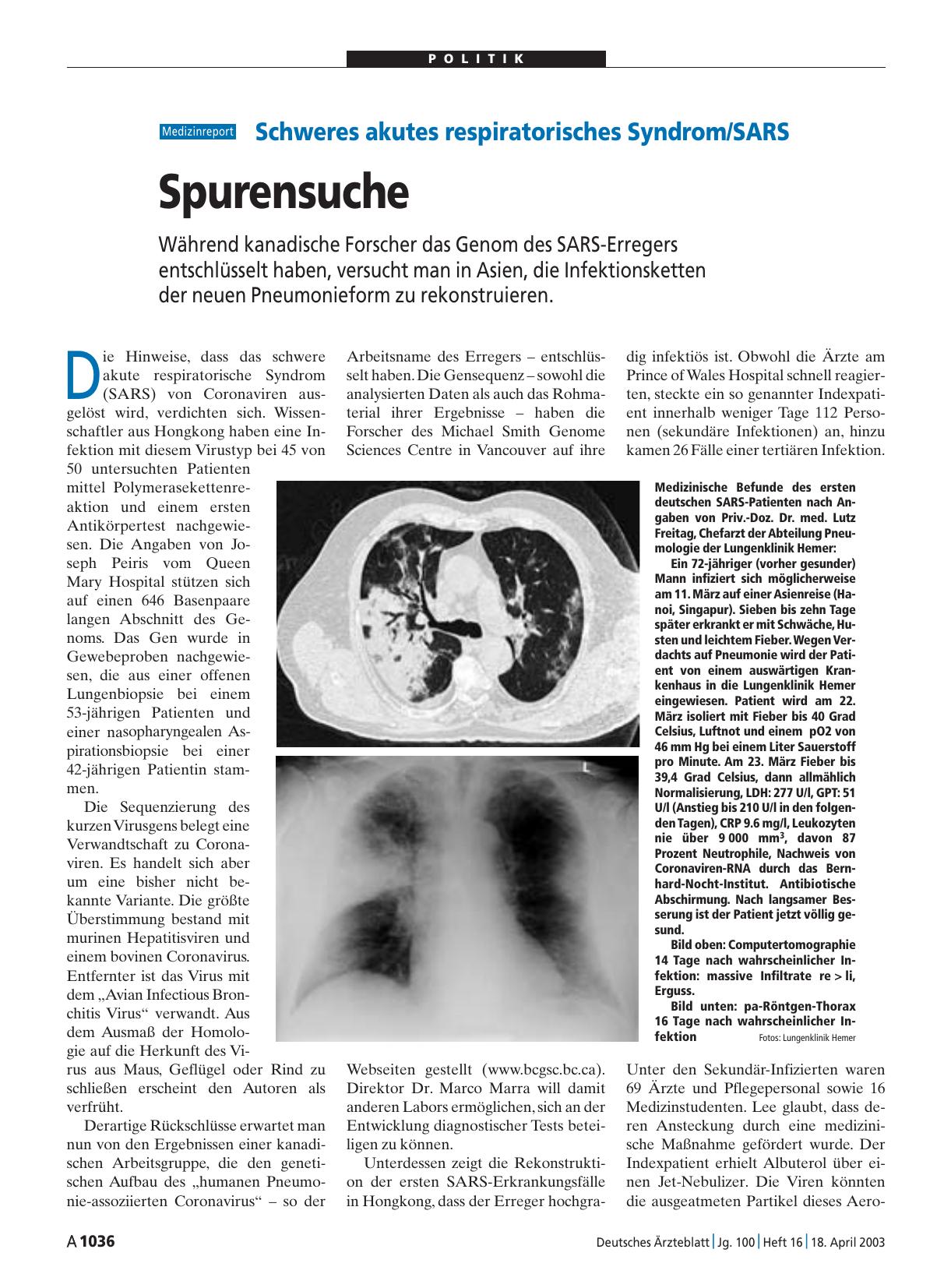 Vorschauseite 1: Schweres akutes respiratorisches Syndrom/SARS: Spurensuche