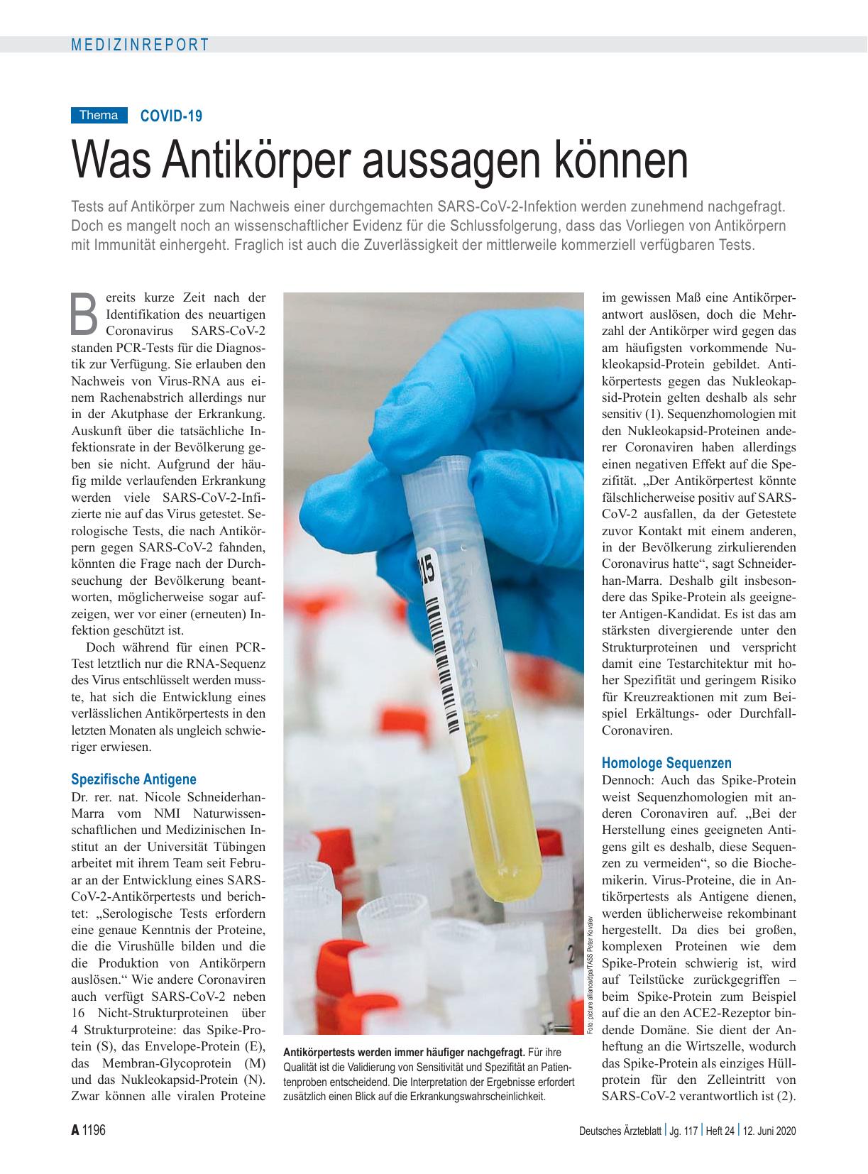 Vorschauseite 1: COVID-19: Was Antikörper aussagen können