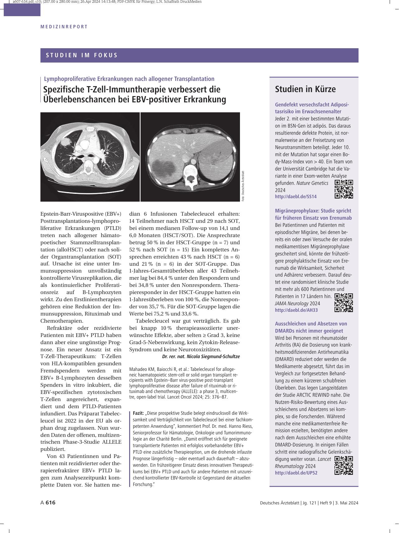 Vorschauseite 1: Lymphoproliferative Erkrankungen nach allogener Transplantation: Spezifische T-Zell-Immuntherapie verbessert die Überlebenschancen bei EBV-positiver Erkrankung