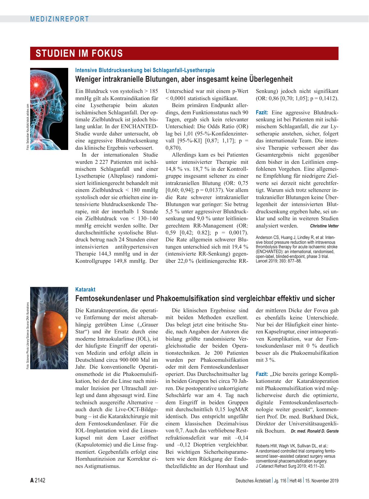Vorschauseite 1: Katarakt: Femtosekundenlaser und Phakoemulsifikation sind vergleichbar effektiv und sicher