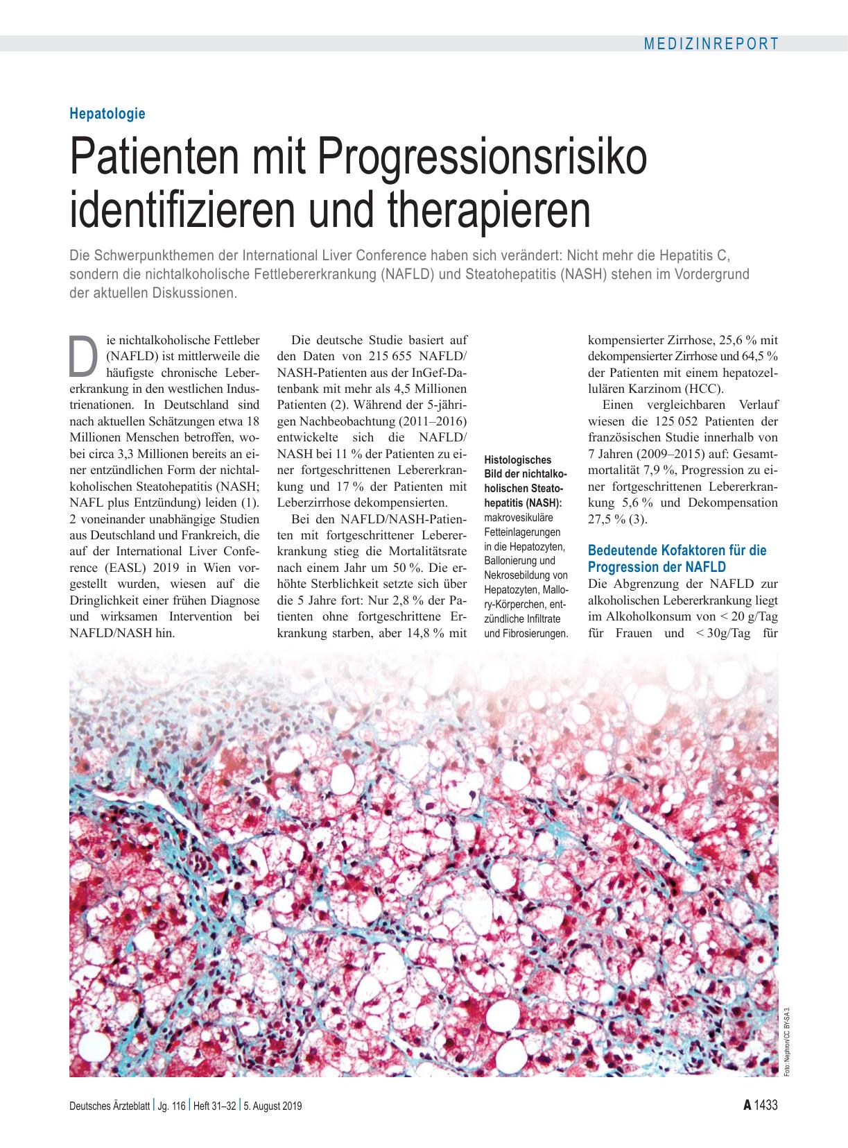 Vorschauseite 1: Hepatologie: Patienten mit Progressionsrisiko identifizieren und therapieren