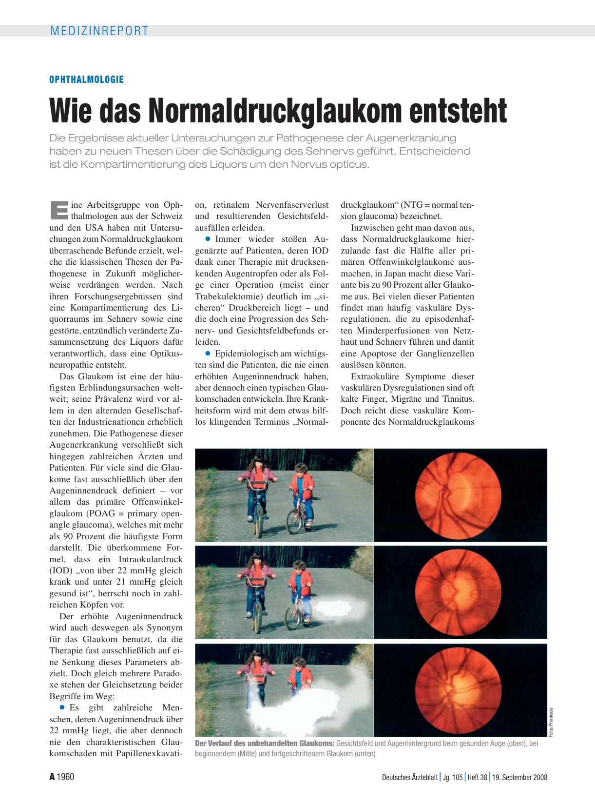 Vorschauseite 1: Ophthalmologie: Wie das Normaldruckglaukom entsteht