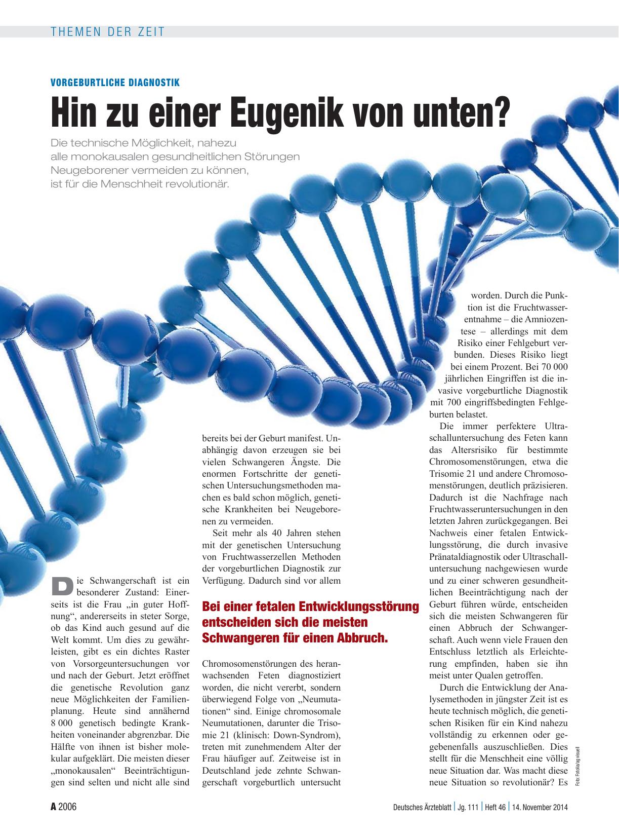 Vorschauseite 1: Vorgeburtliche Diagnostik: Hin zu einer Eugenik von unten?
