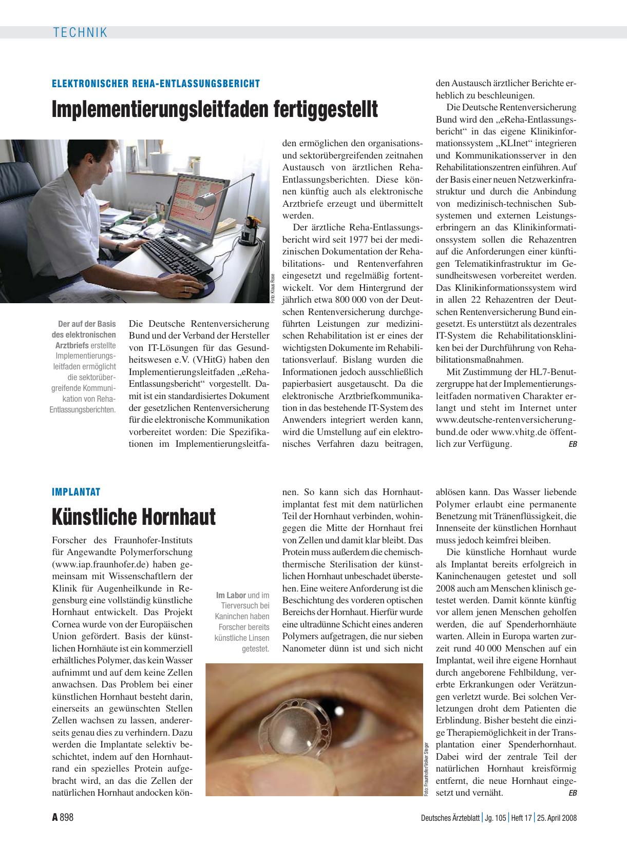 Vorschauseite 1: Implantat: Künstliche Hornhaut