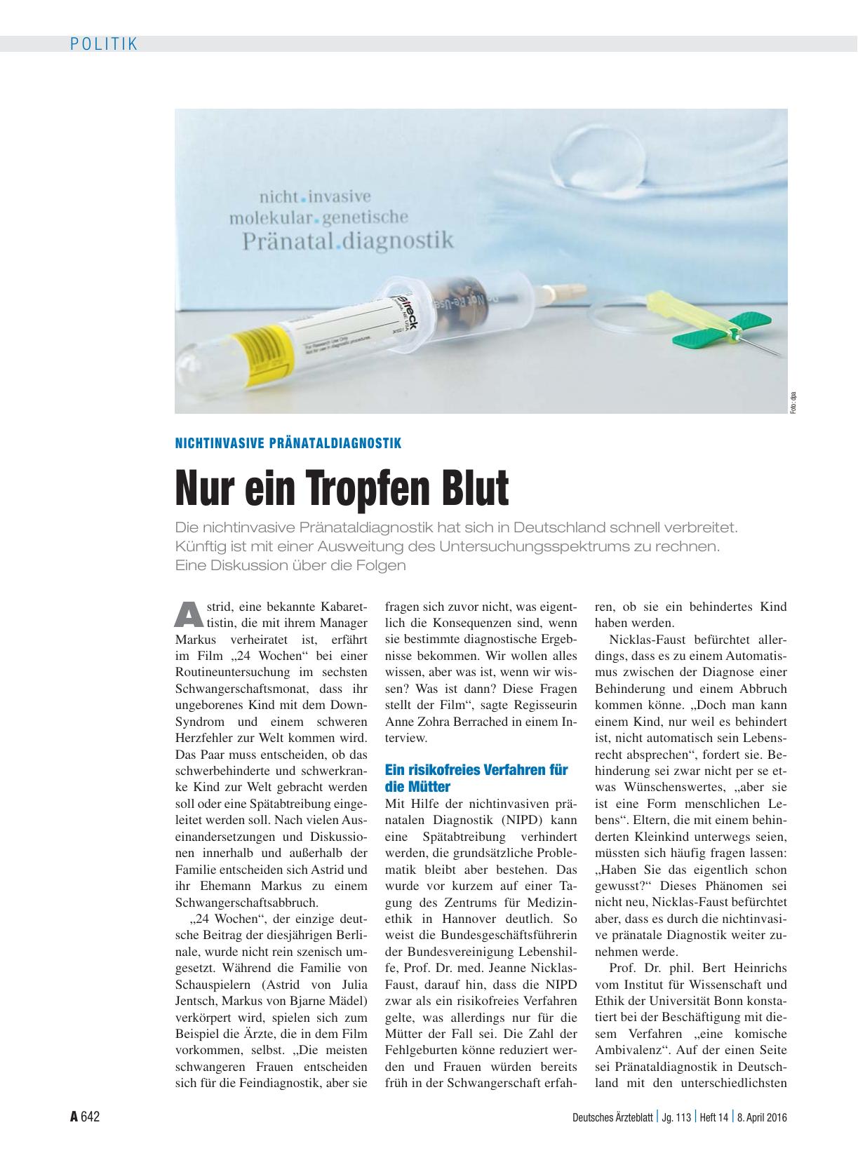 Vorschauseite 1: Nichtinvasive Pränataldiagnostik: Nur ein Tropfen Blut