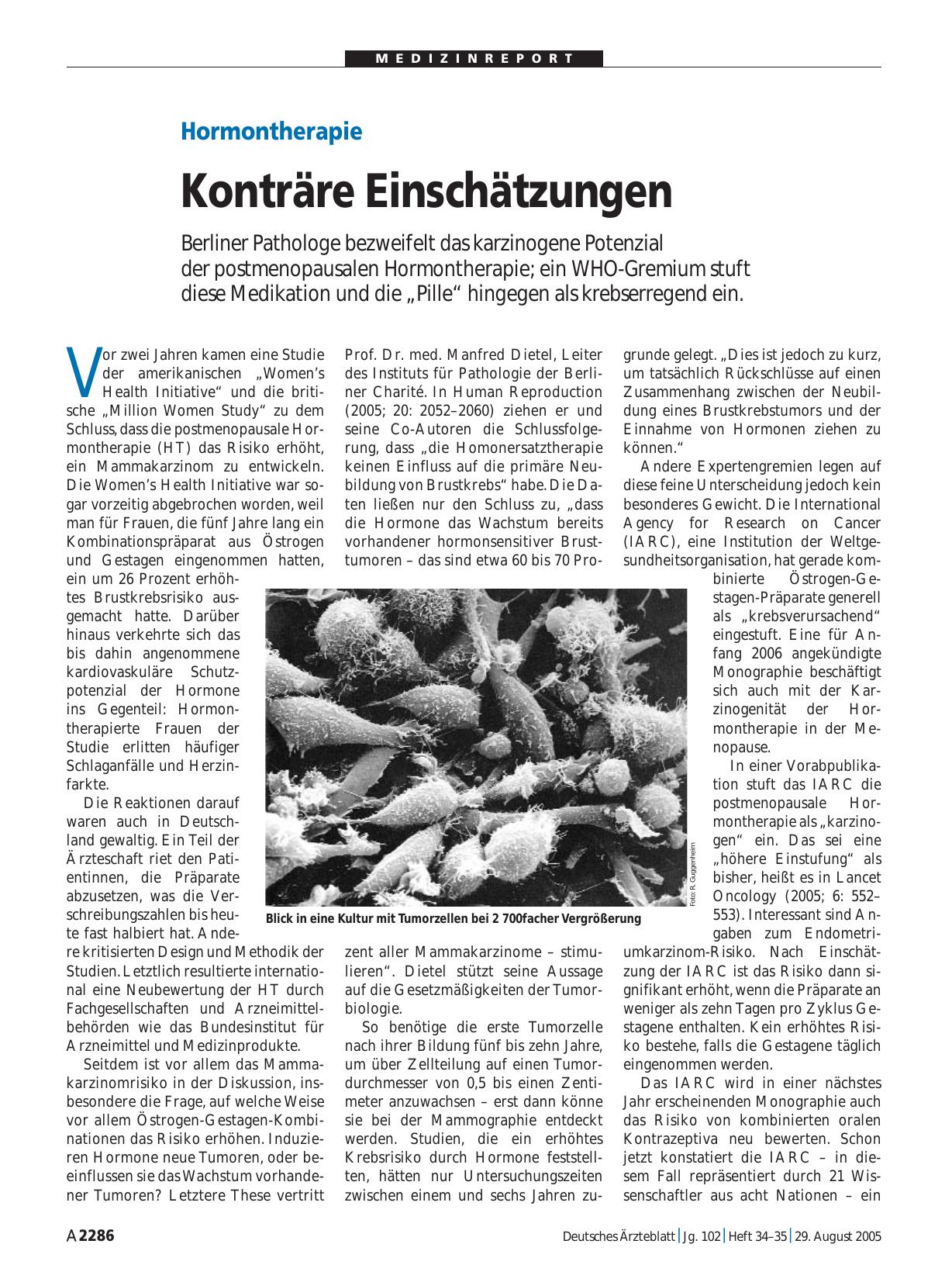 Vorschauseite 1: Hormontherapie: Konträre Einschätzungen
