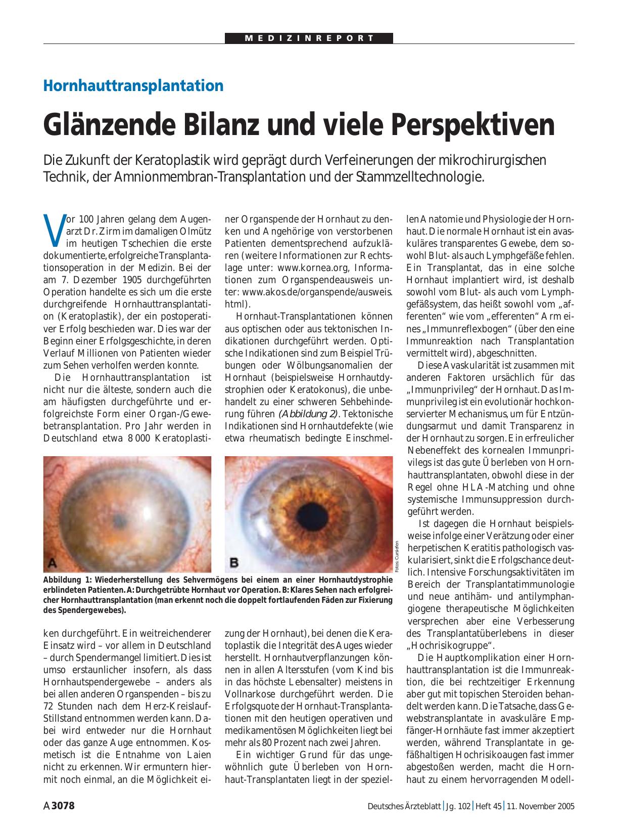 Vorschauseite 1: Hornhauttransplantation: Glänzende Bilanz und viele Perspektiven