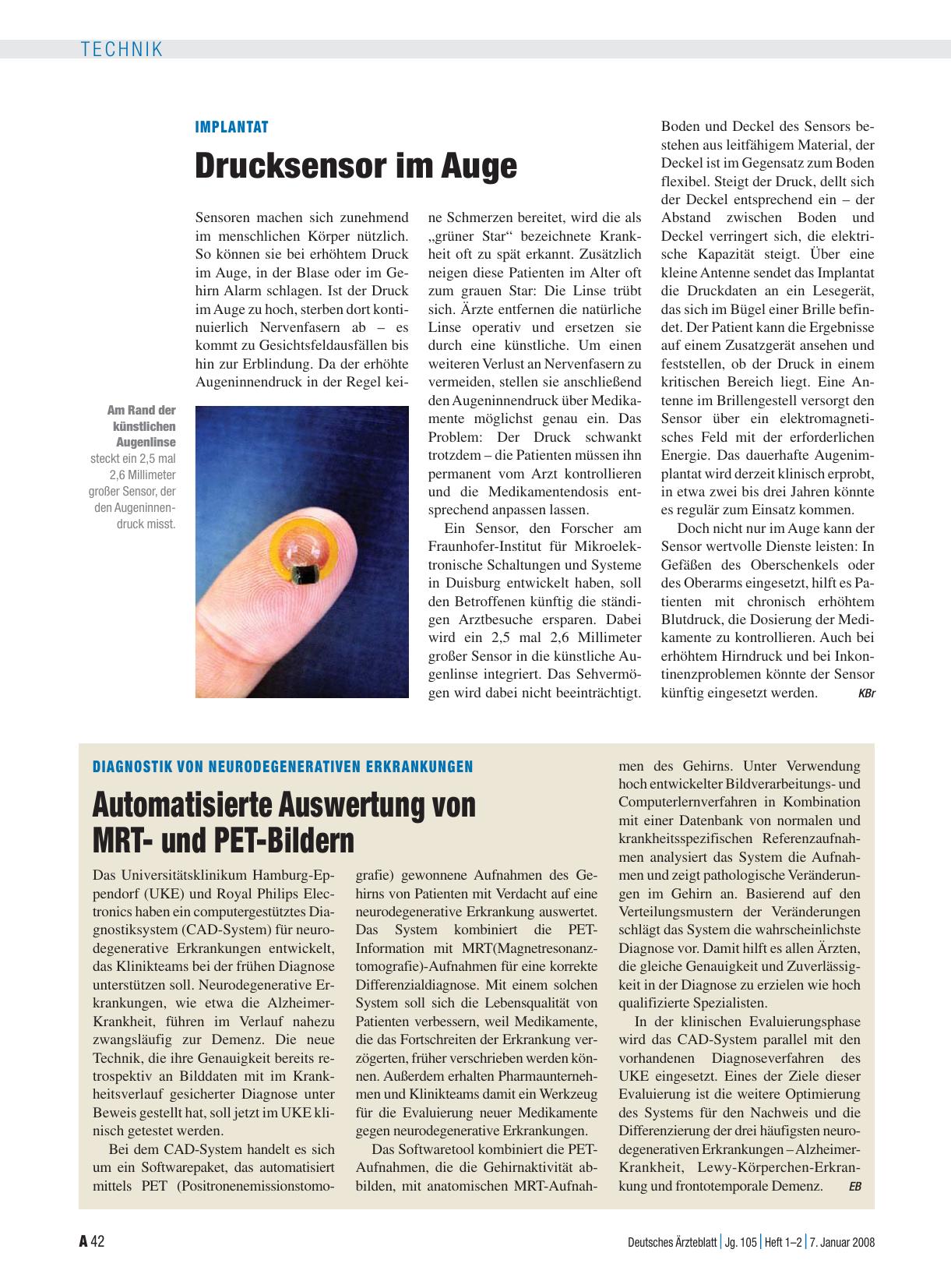 Vorschauseite 1: Implantat: Drucksensor im Auge