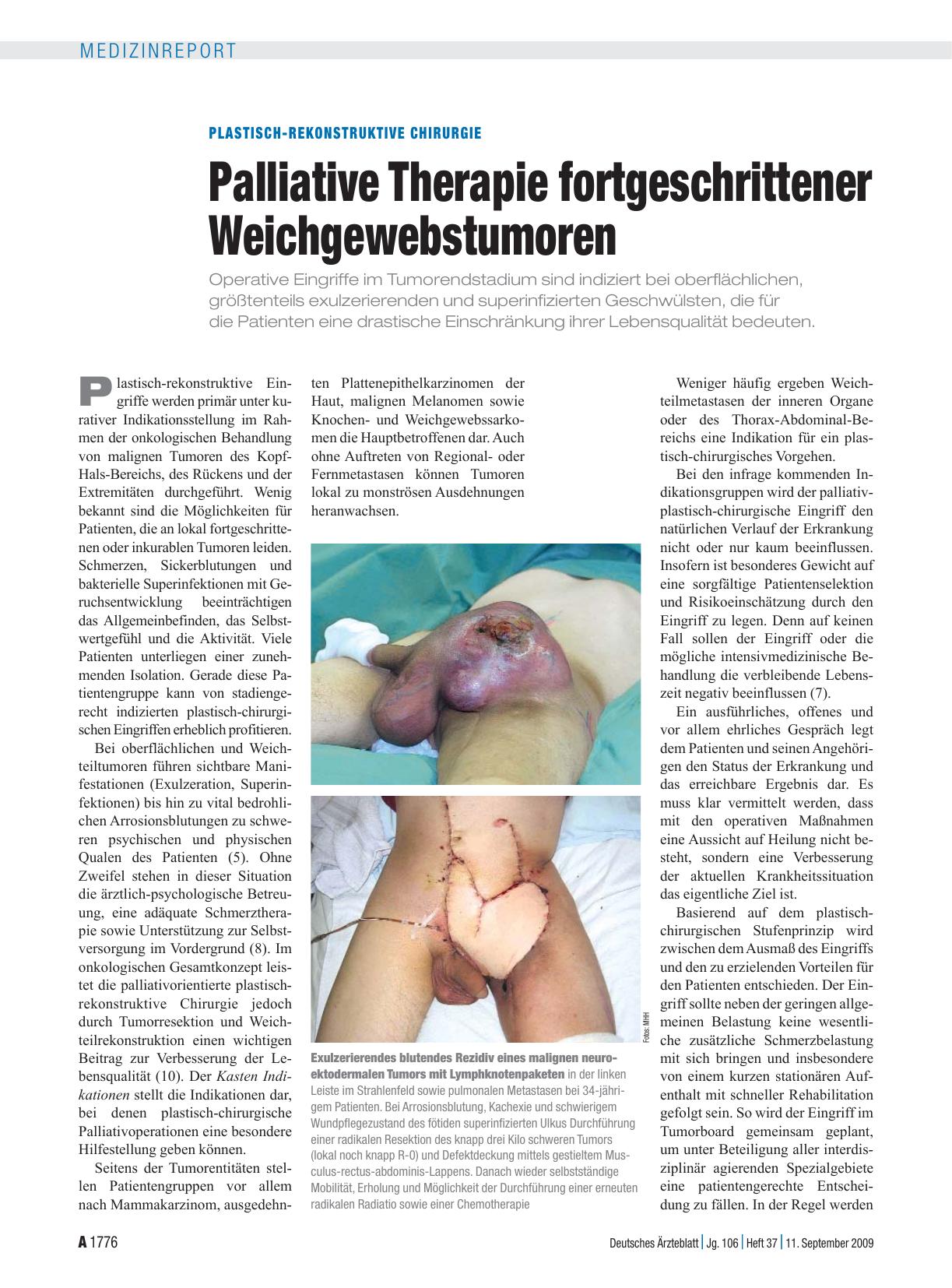 Vorschauseite 1: Plastisch-rekonstruktive Chirurgie: Palliative Therapie fortgeschrittener Weichgewebstumoren