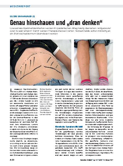 Vorschauseite 1: Seltene Erkrankungen (2): Genau hinschauen und „dran denken“