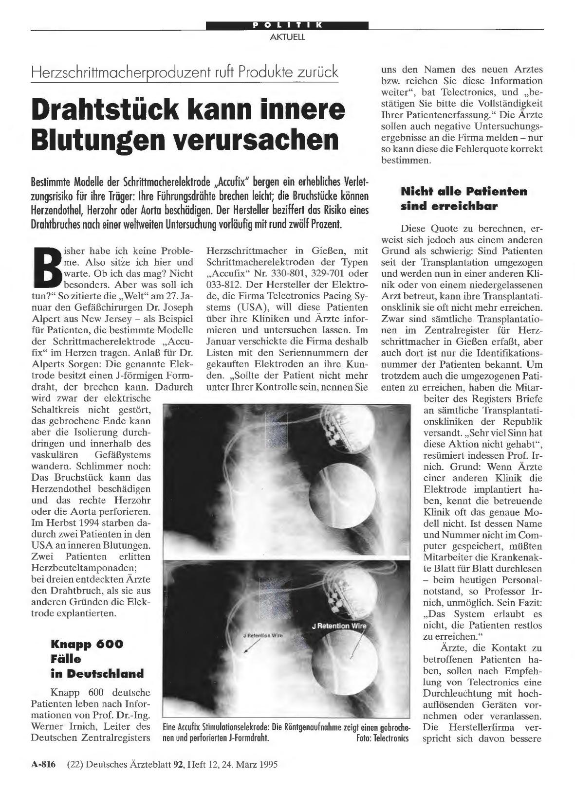 Vorschauseite 1: Herzschrittmacherproduzent ruft Produkte zurück: Drahtstück kann innere Blutungen verursachen