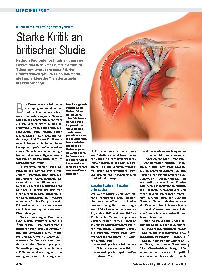 Vorschauseite 1: Subakromiales Impingementsyndrom: Starke Kritik an britischer Studie