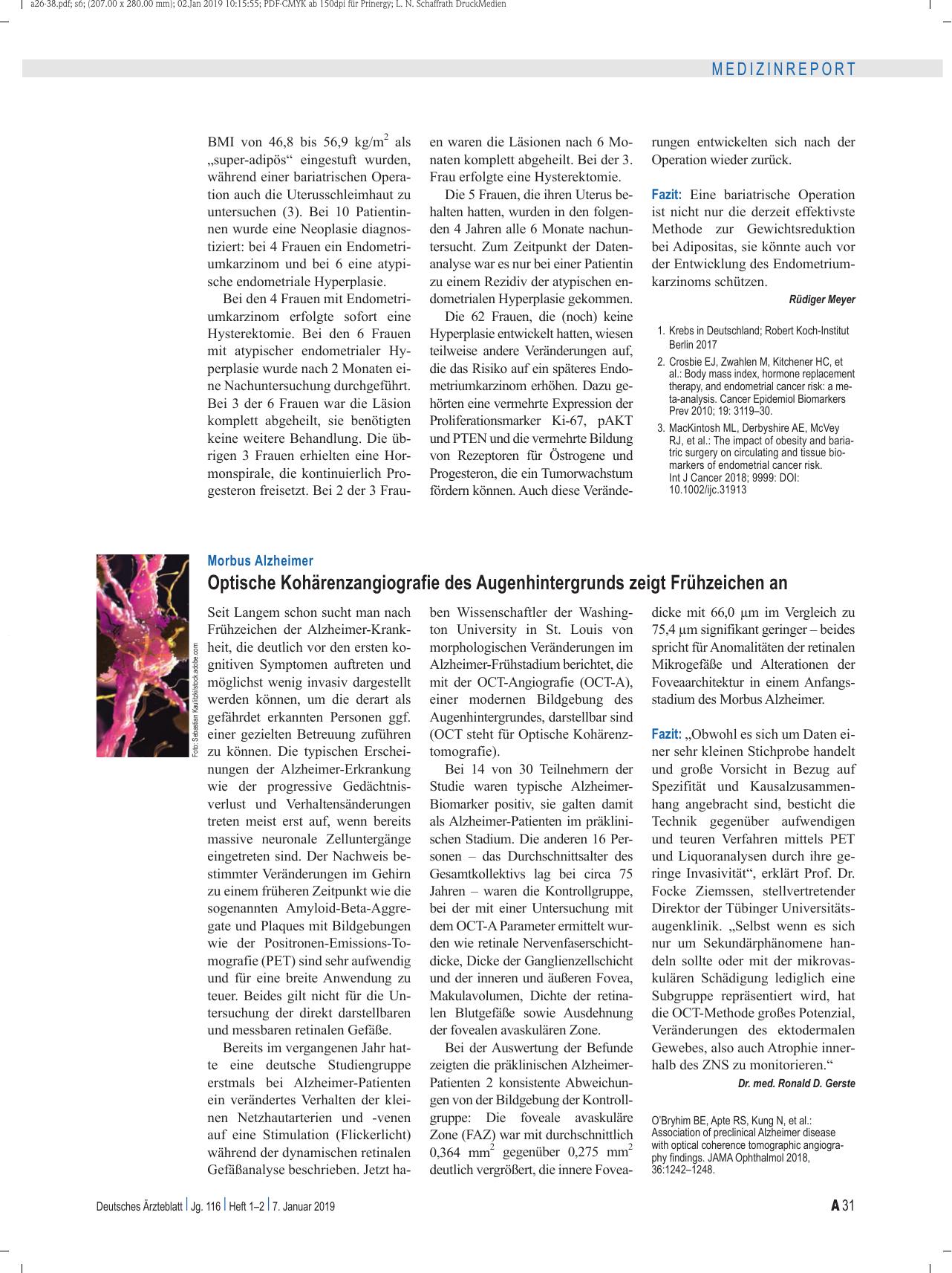 Vorschauseite 1: Morbus Alzheimer: Optische Kohärenzangiografie des Augenhintergrunds zeigt Frühzeichen an