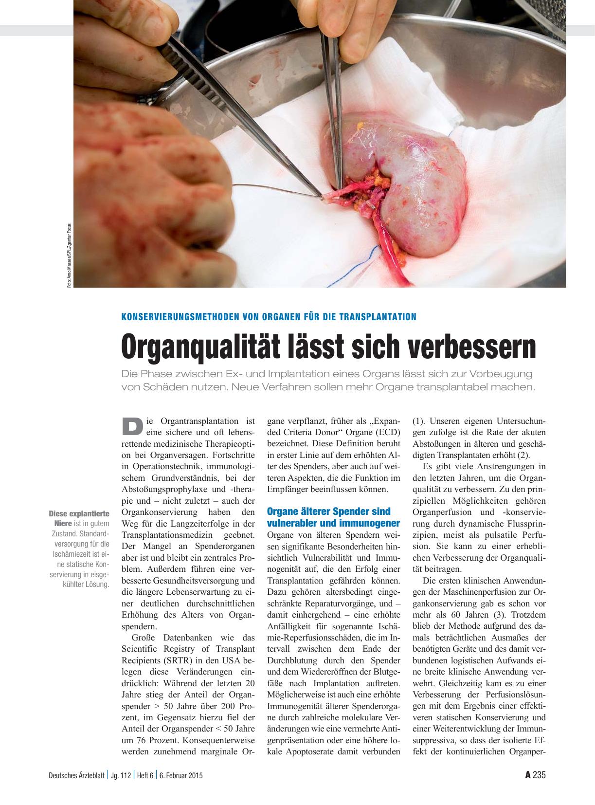 Vorschauseite 1: Konservierungsmethoden von Organen für die Transplantation: Organqualität lässt sich verbessern