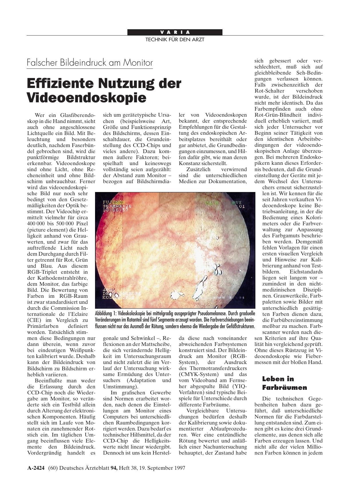 Vorschauseite 1: Falscher Bildeindruck am Monitor: Effiziente Nutzung der Videoendoskopie