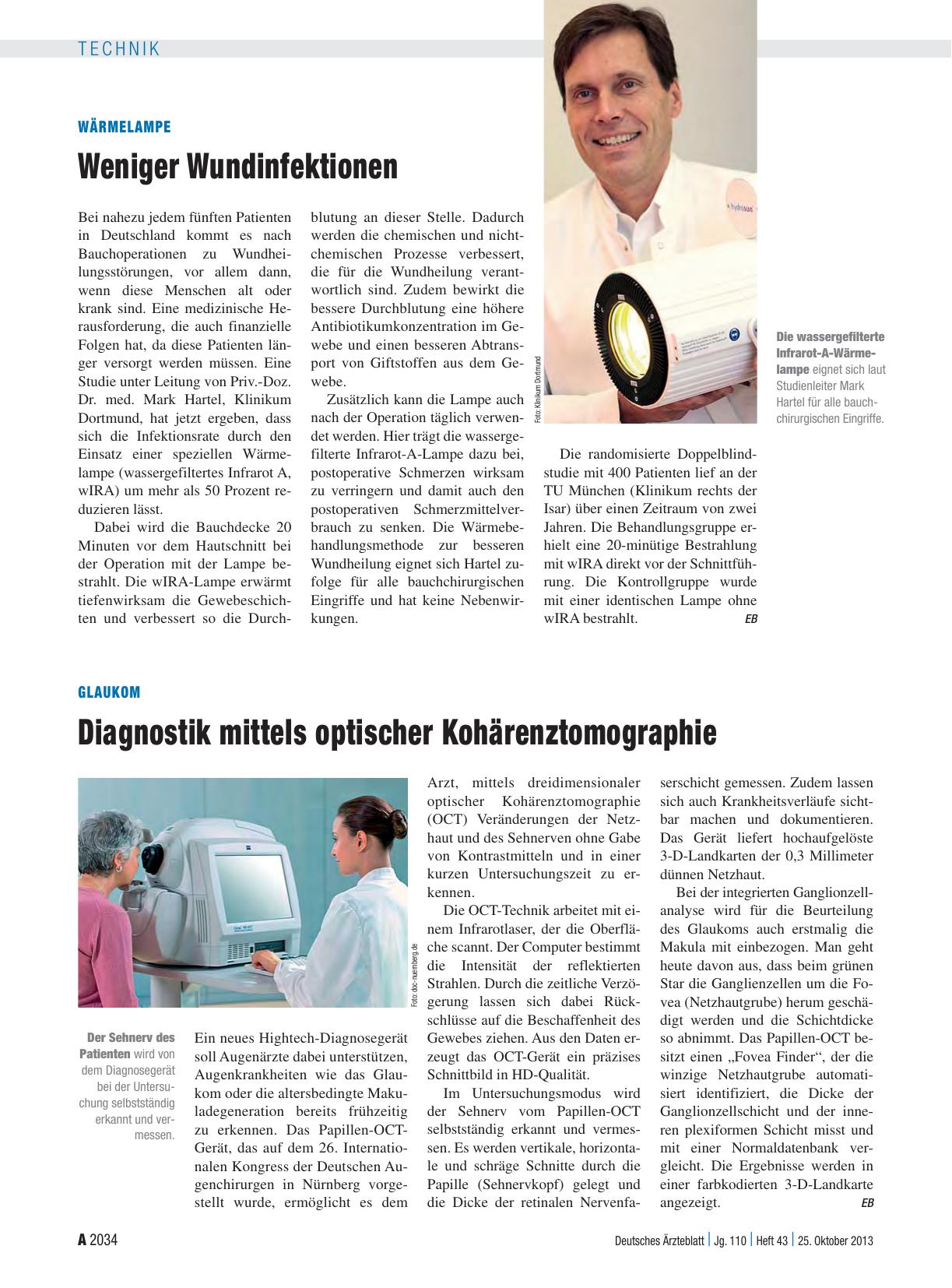 Vorschauseite 1: Glaukom: Diagnostik mittels optischer Kohärenztomographie