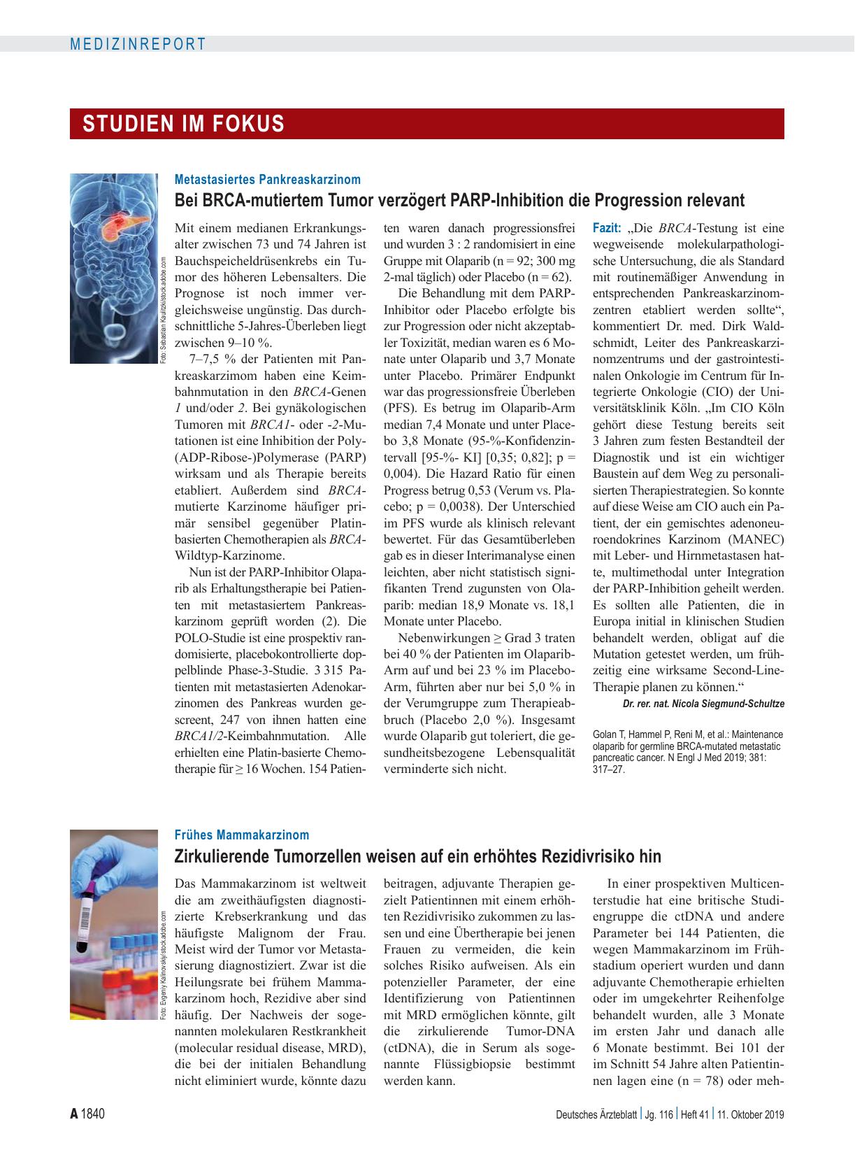 Vorschauseite 1: Metastasiertes Pankreaskarzinom: Bei BRCA-mutiertem Tumor verzögert PARP-Inhibition die Progression relevant