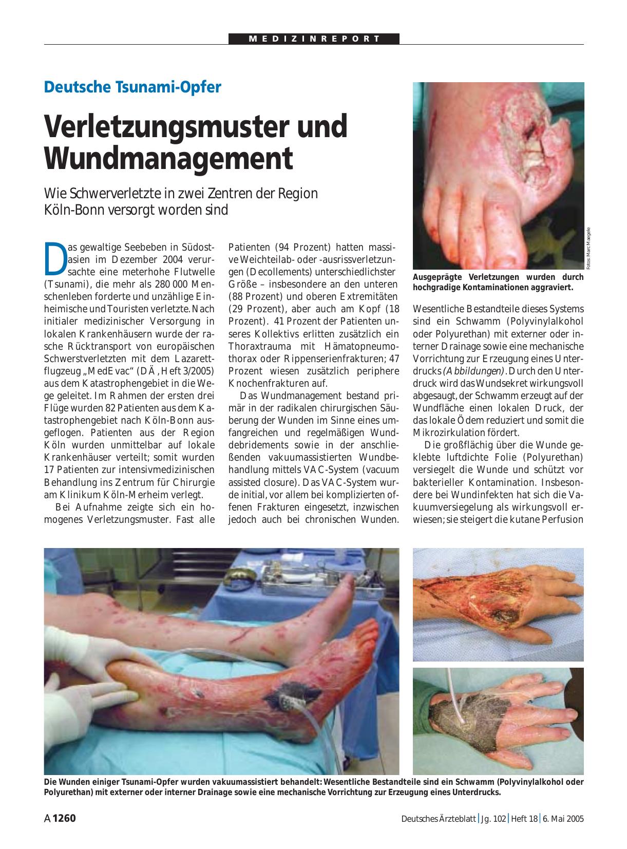 Vorschauseite 1: Deutsche Tsunami-Opfer: Verletzungsmuster und Wundmanagement